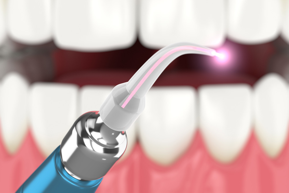 dental diode laser used to treat gums